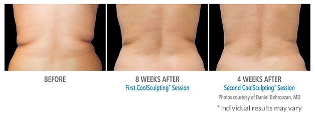B&A-Behroozan-FL-3Set-16wk-LoRes