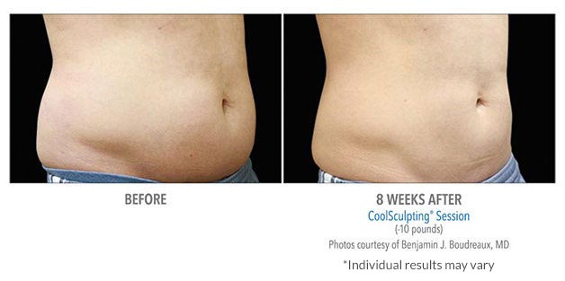 B&A-Boudreaux-AB-2Set-8wk-3Q-LoRes