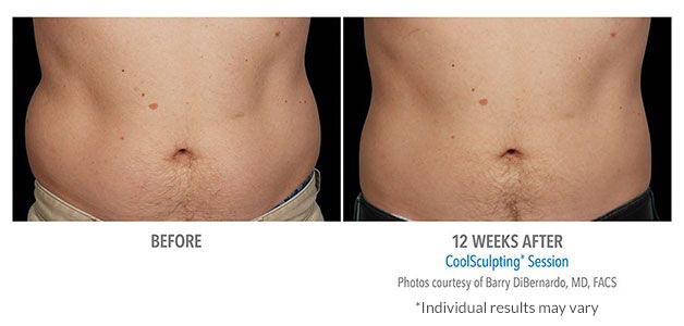 B&A-DiBernardo-AB-2Set-12wk-LoRes