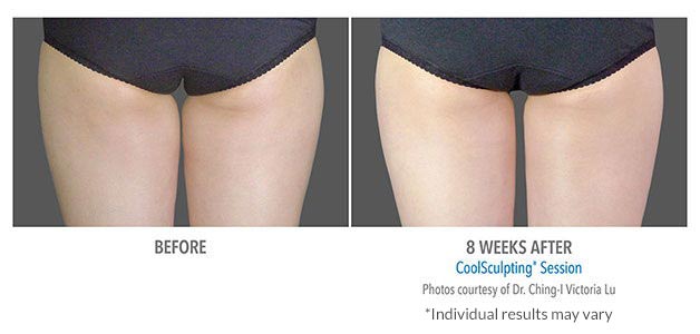 B&A-Lu-INTH-2Set-8wk-Back-LoRes