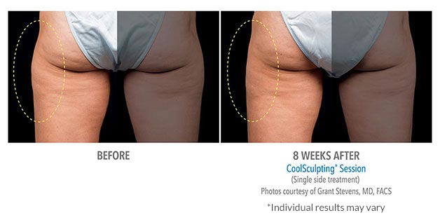 B&A-Stevens-OUTH-2Set-8wk-LeftBack-LoRes